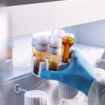 Sample preparation